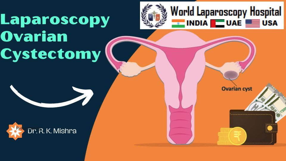 Post Operative Care After Laparoscopy Ovarian Cystectomy